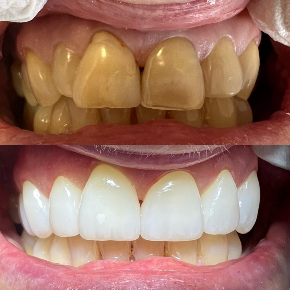 Gallery Evergreen Dental Cork City Dentist